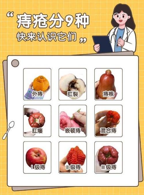 痔疮