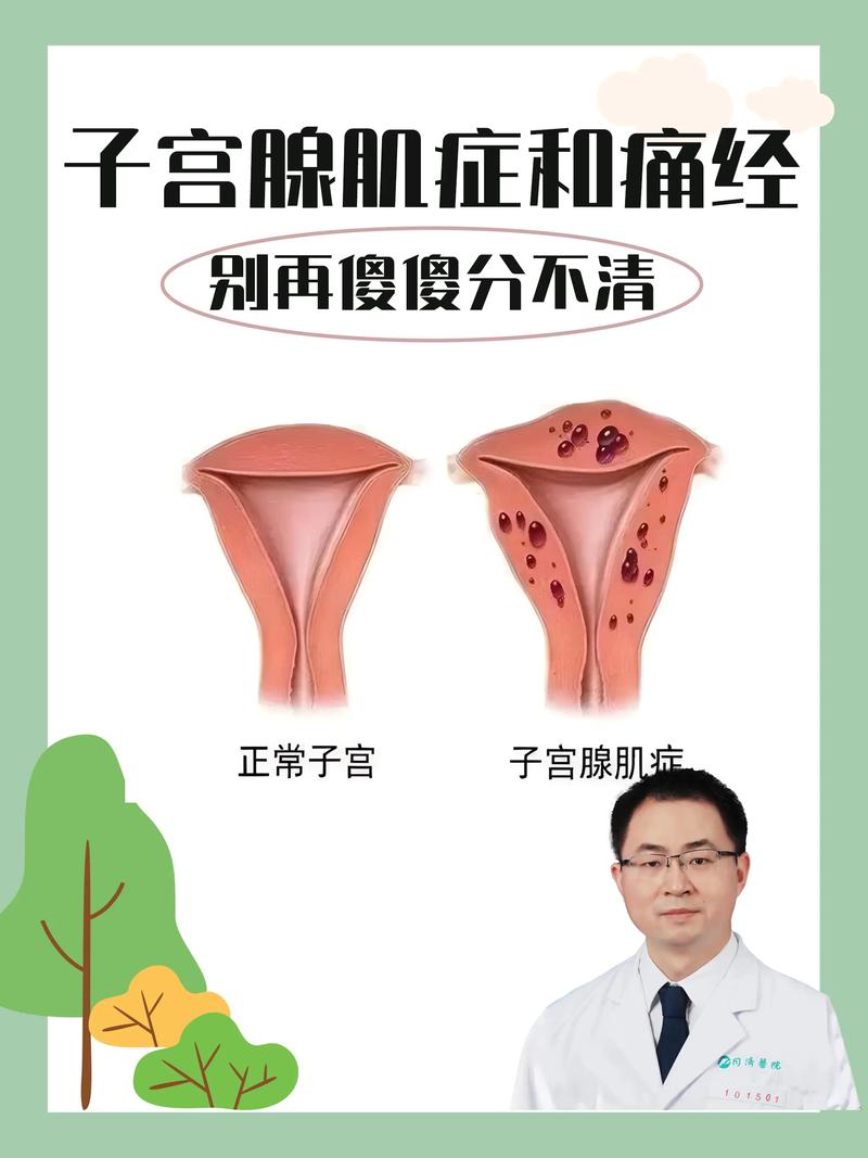 肌腺症