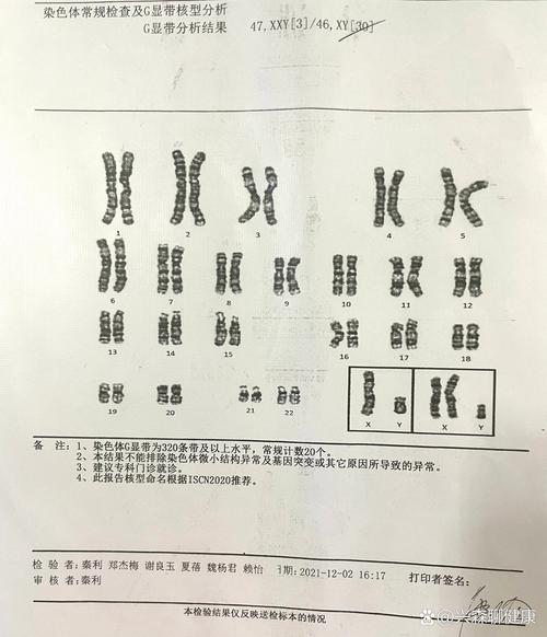  染色体异常