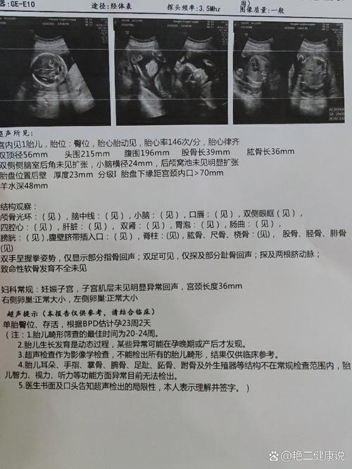 大排畸