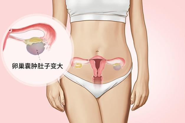 卵巢位置
