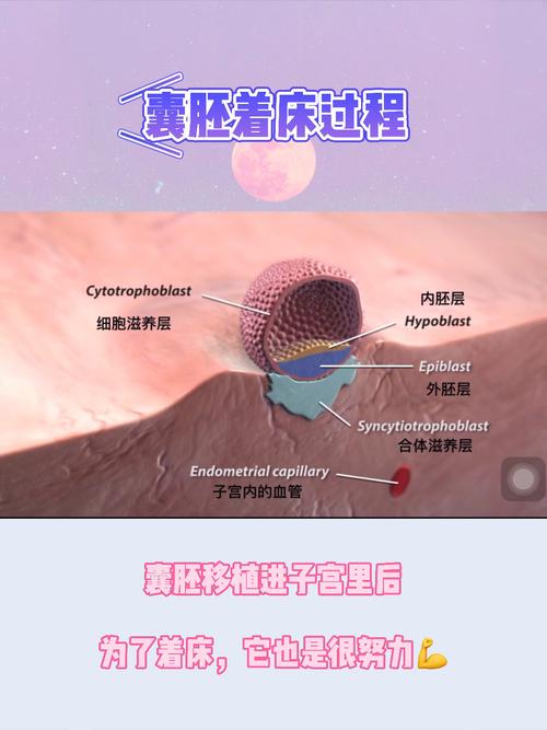 人工内膜移植