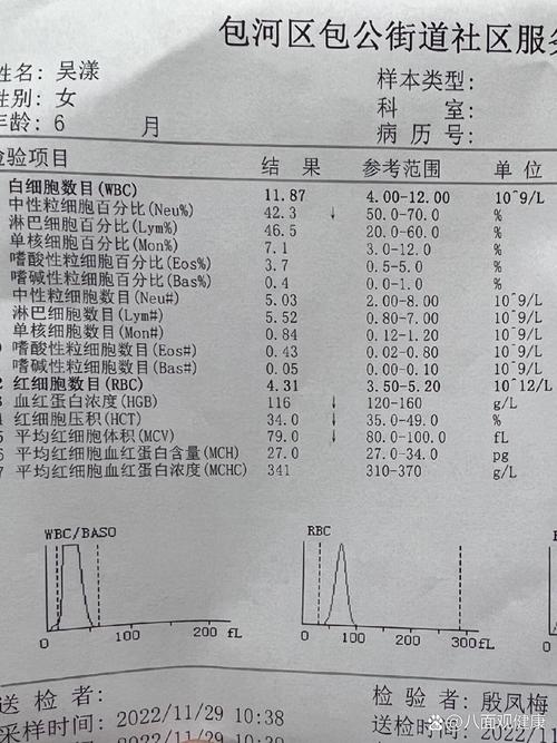 血浆蛋白浓度