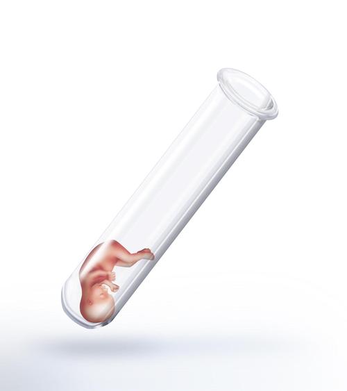 甲状腺切除、试管婴儿、辅助生殖