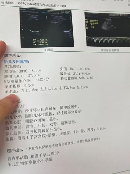 超声宝宝偏小