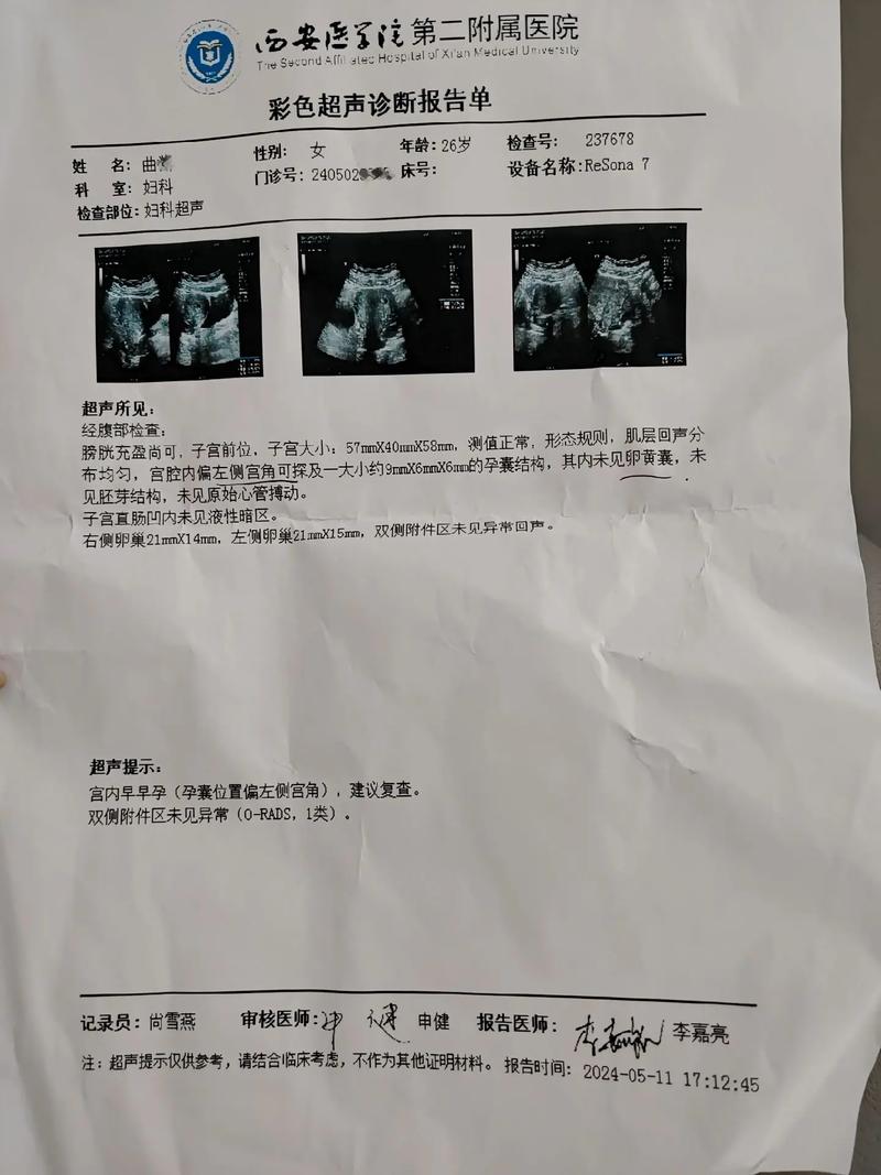 试管怀孕 7 周