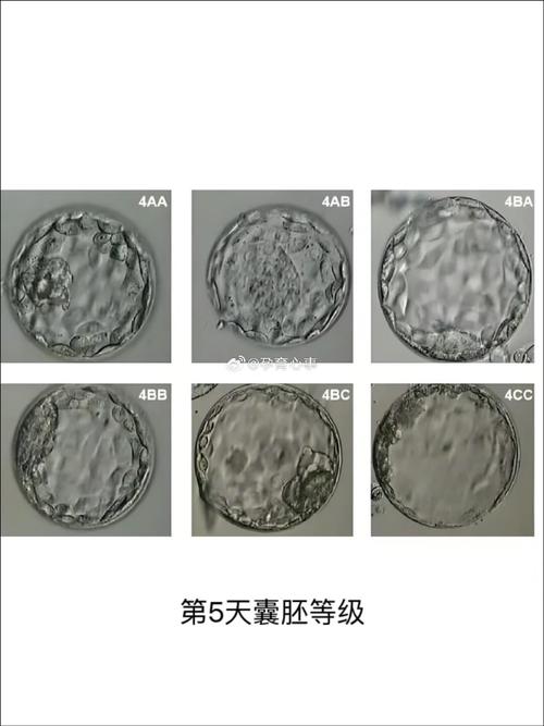 试管婴儿质量