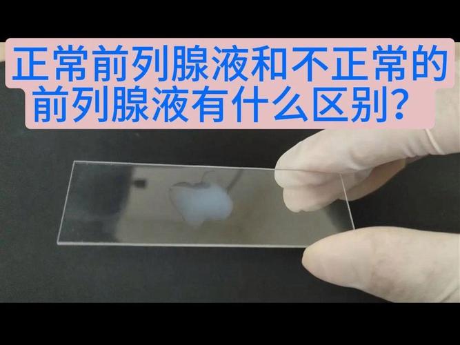 前列腺液