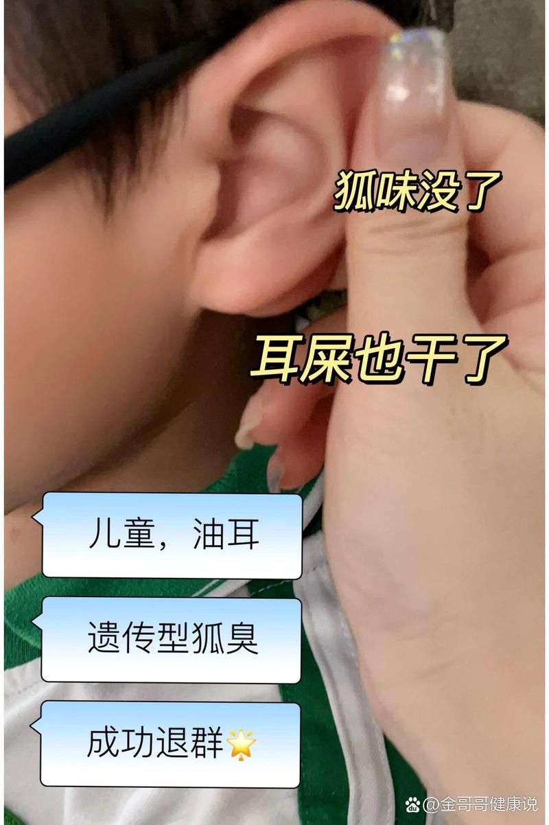 先天狐臭
