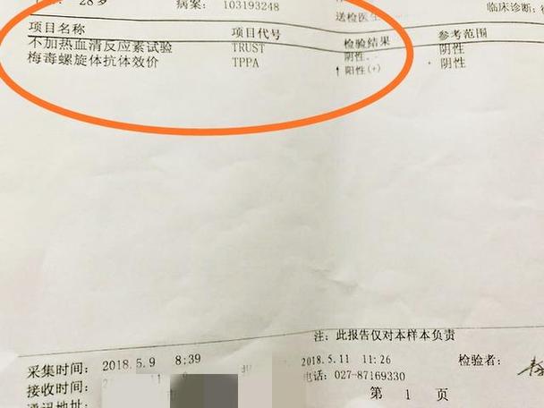 梅毒阳性