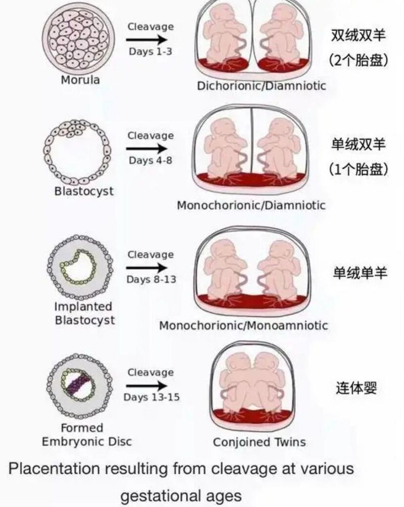 双胎概率
