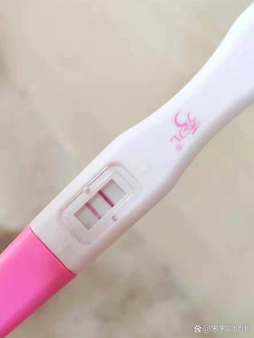 假性怀孕