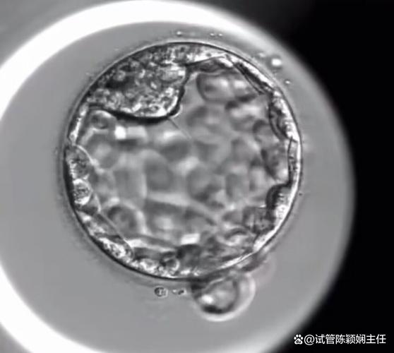 北京试管婴儿、囊胚移植、生殖医疗