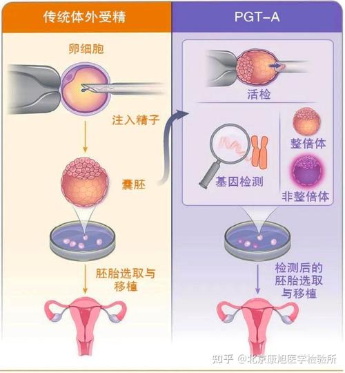 试管婴儿、发育迟缓、医疗技术、生殖健康