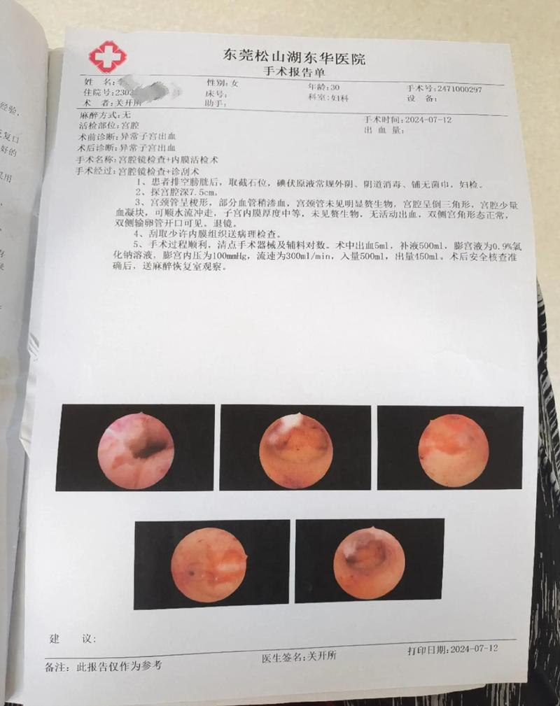  宫腔镜检查