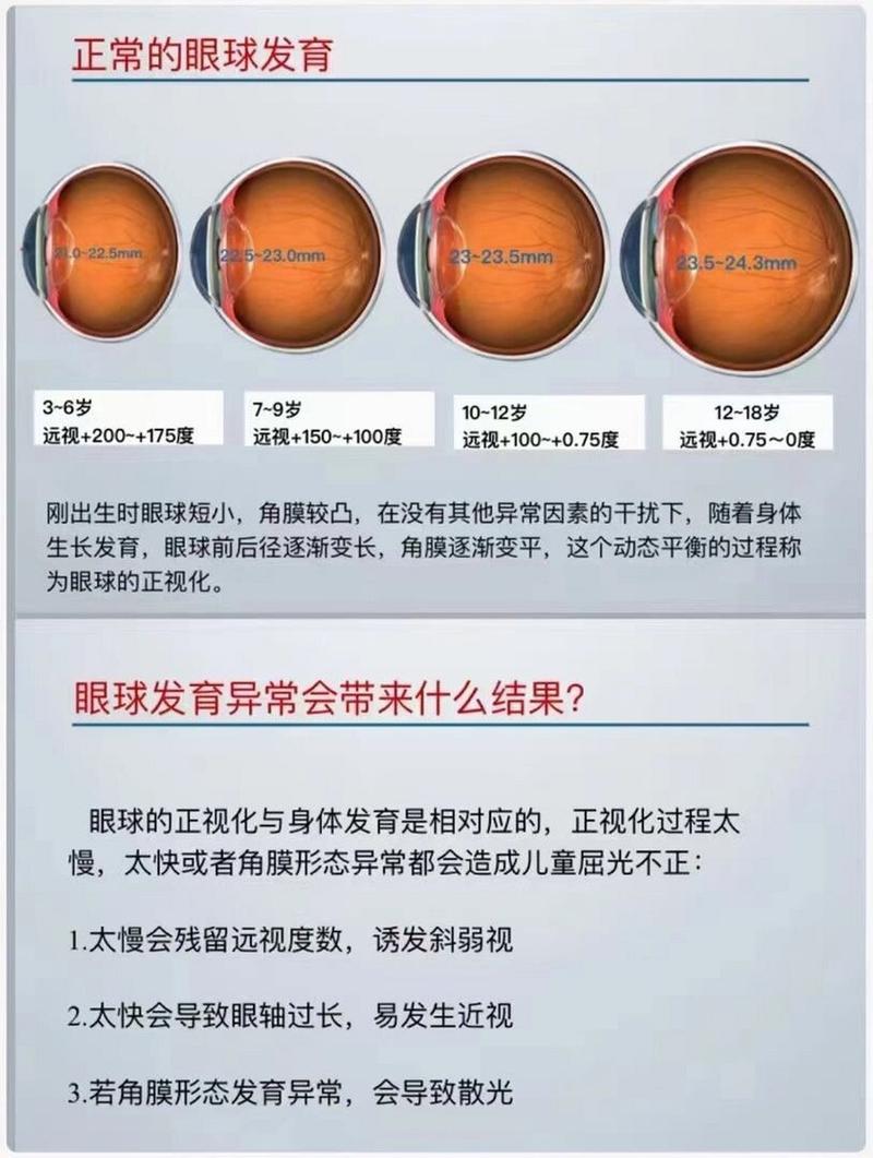 眼部发育