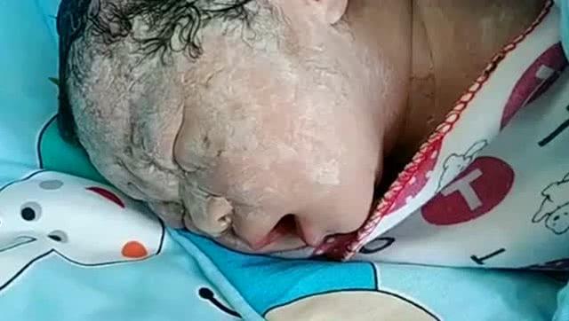 试管婴儿的长相真的不一样吗？