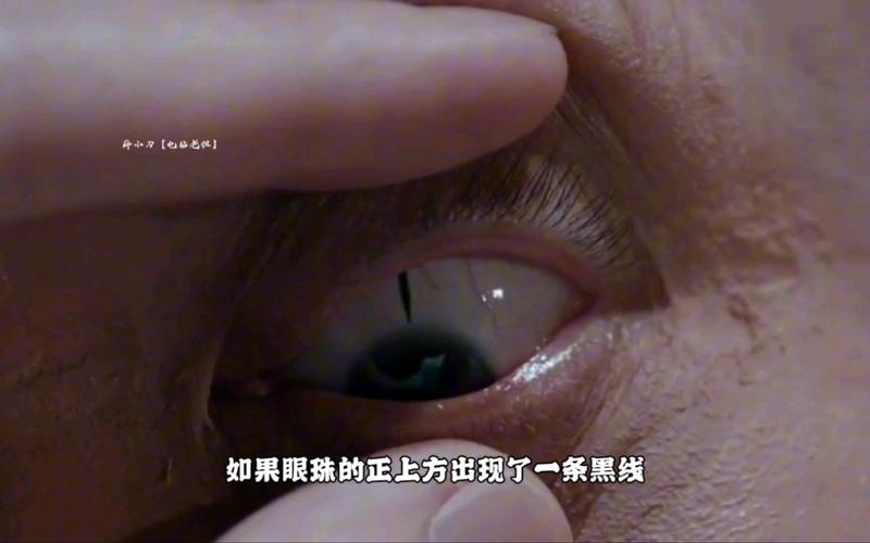眼睛黑线