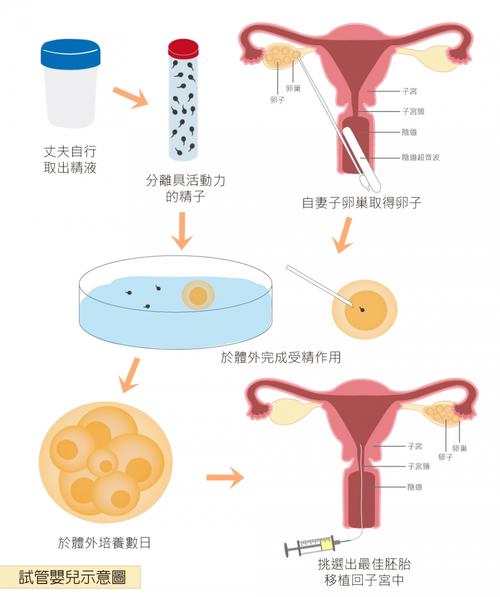 试管婴儿的生成原理是什么？