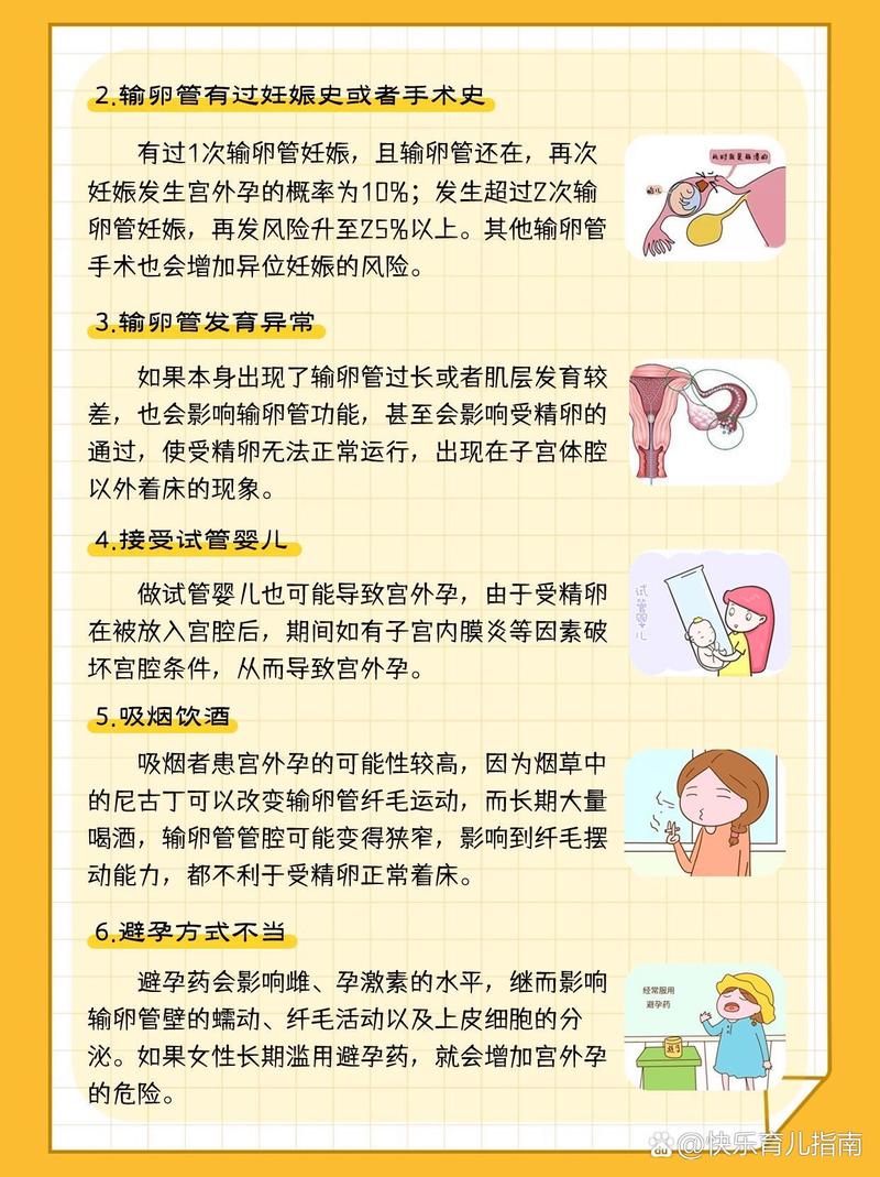 卵巢妊娠风险