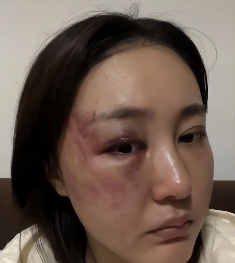 徐大宝的诞生秘密：他是试管婴儿吗？