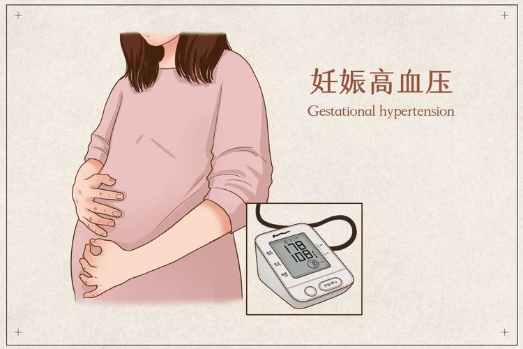 妊娠期高血压