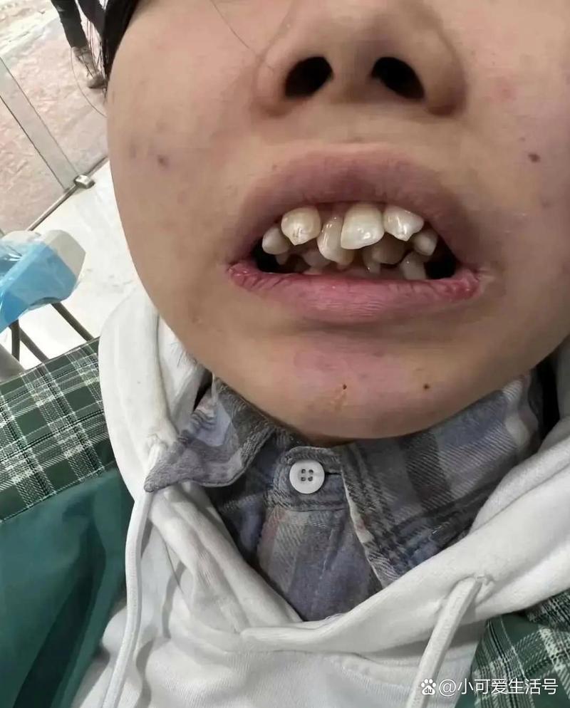 牙齿异常