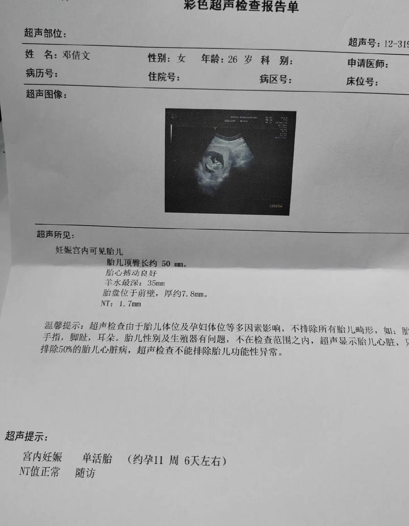 30天阴超