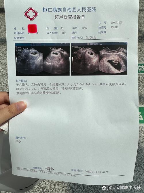 二超
