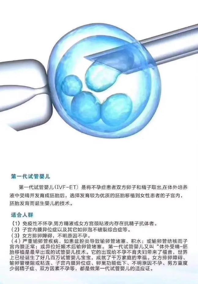 试管婴儿能优化基因选择吗？