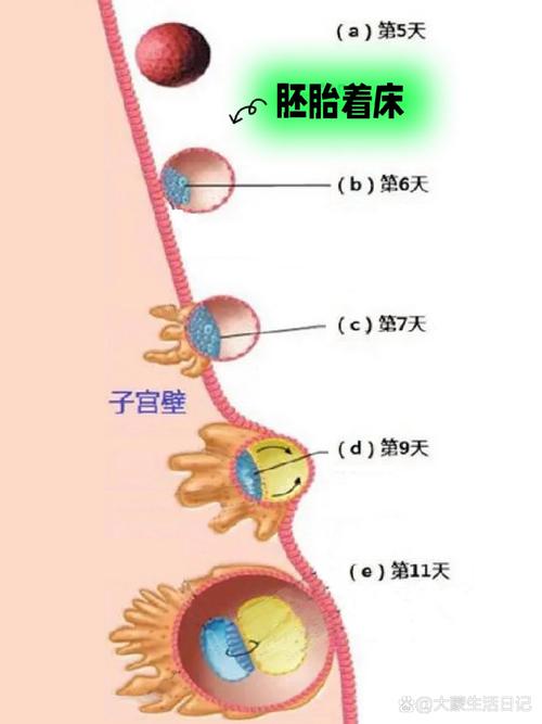  子宫着床