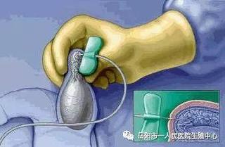 岳阳试管婴儿
