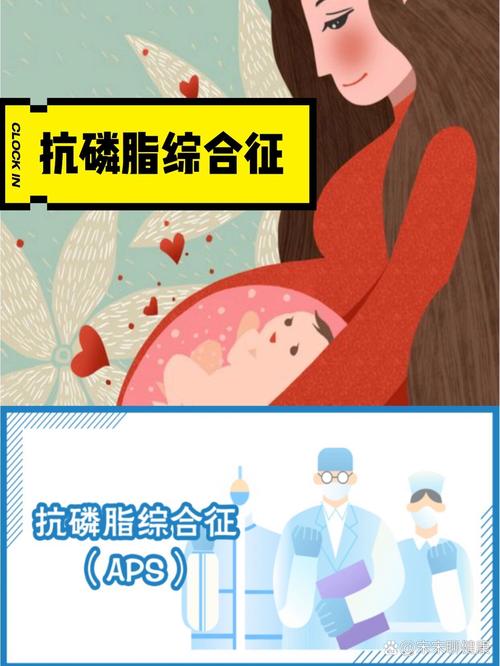 抗磷脂综合征