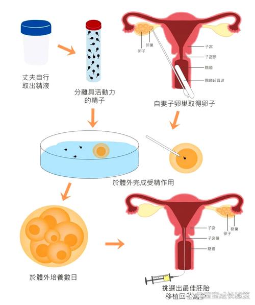 设计试管婴儿：疗法还是选择？