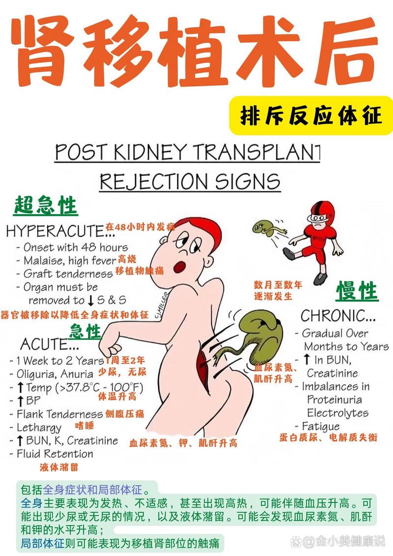 排斥反应