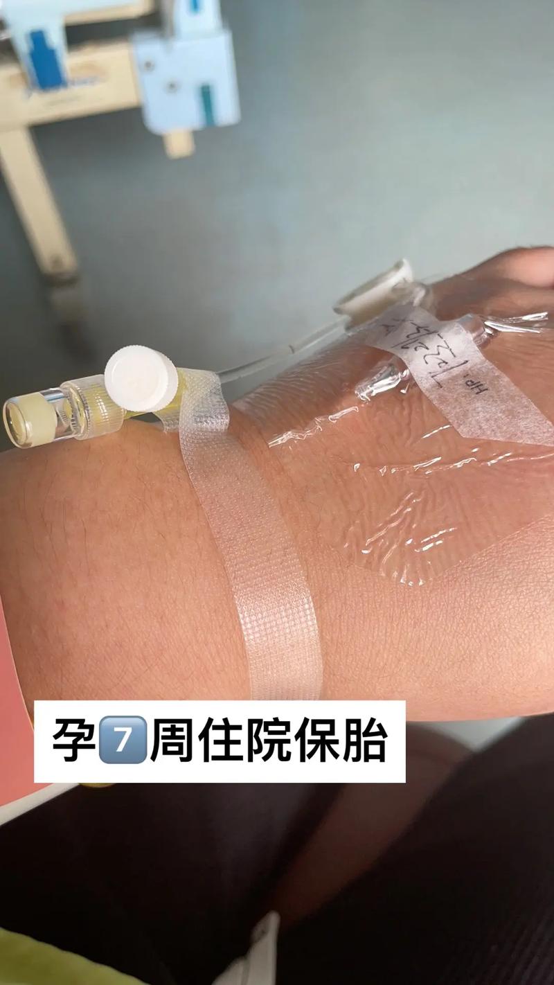  保胎治疗