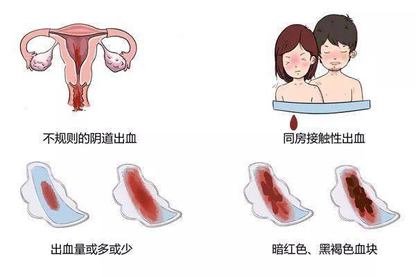 阴道出血