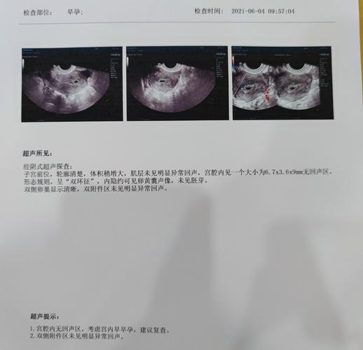试管婴儿植入18天，心情如何？