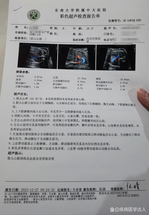 心脏彩超