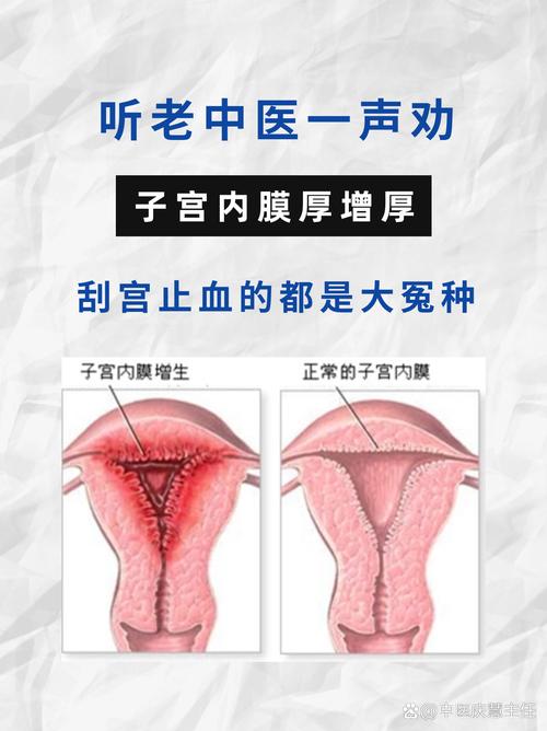 内膜厚原因