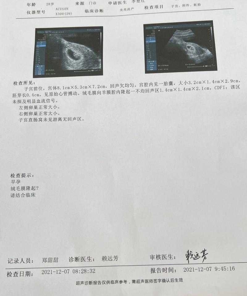  绒毛检查