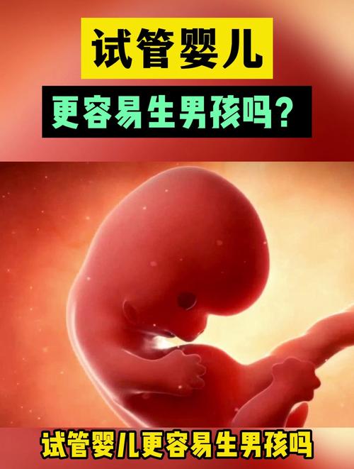 试管婴儿男孩