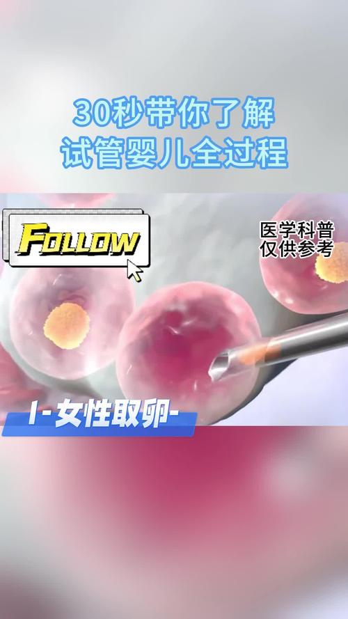 跨国试管婴儿