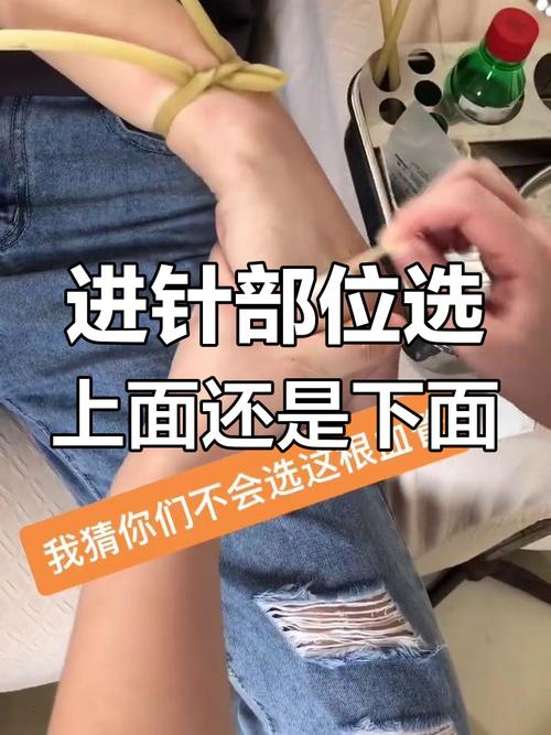  进针位置