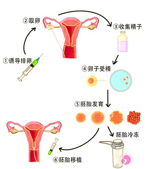 试管到子宫