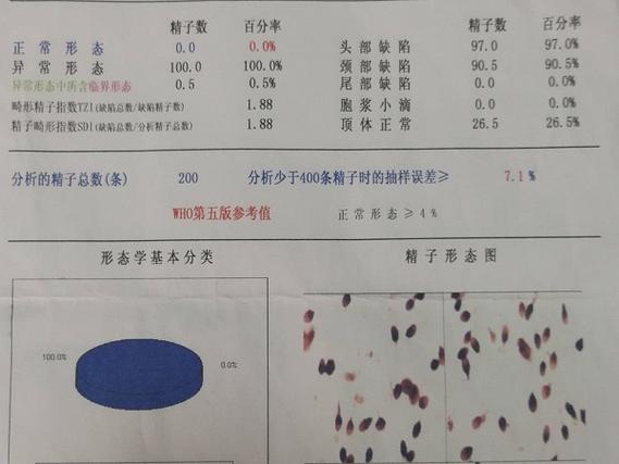 精子形态分析