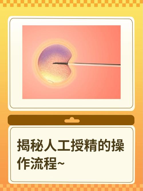 人工授精技术