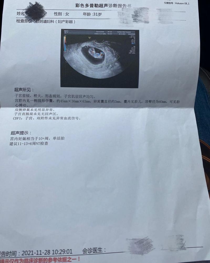 怀孕10周