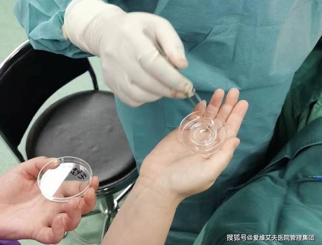  精子抽吸术