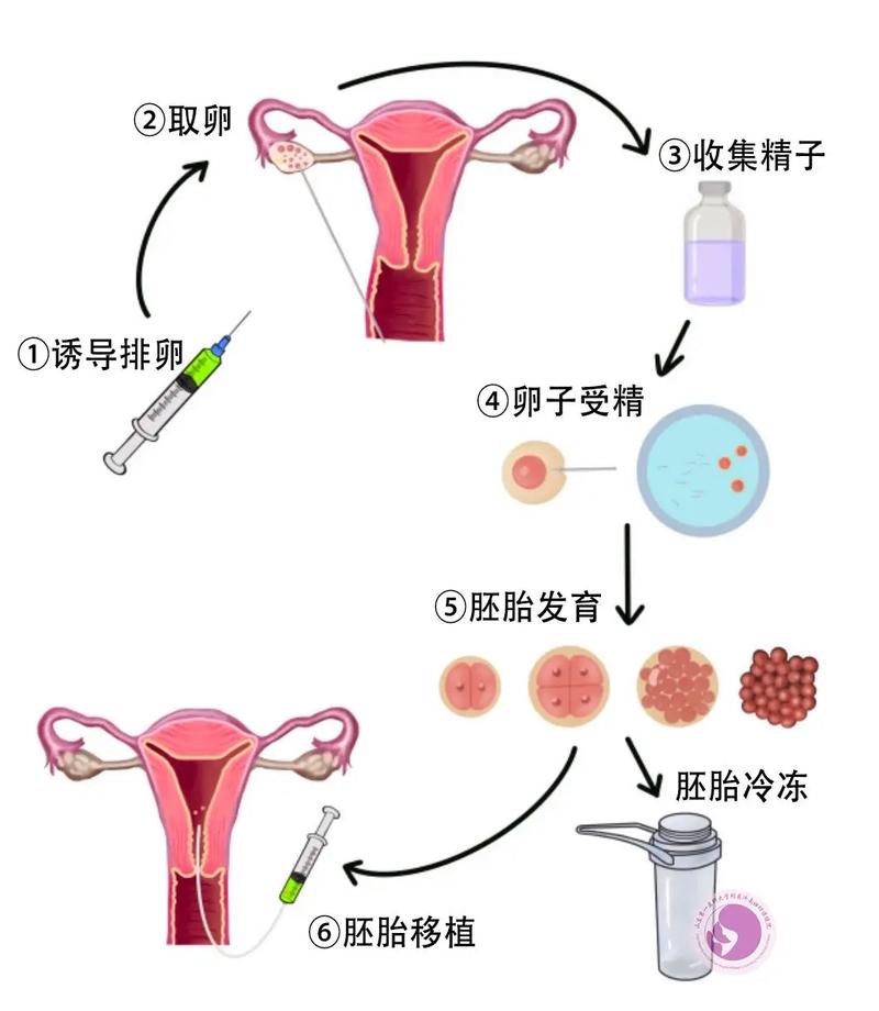 试管婴儿阶段
